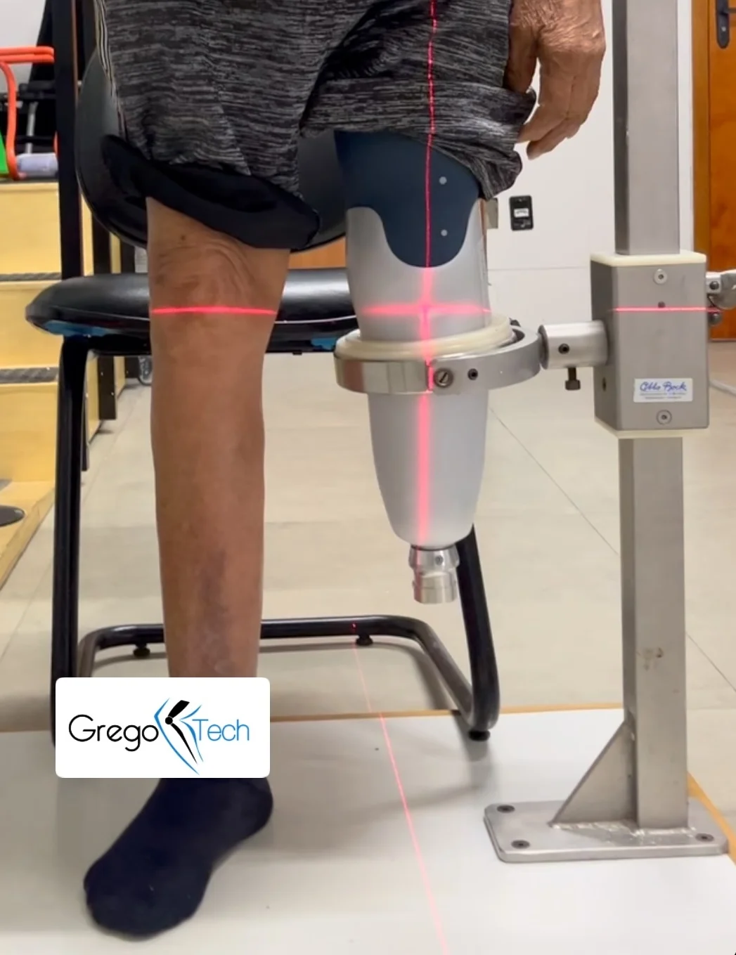 Alinhamento de uma prótese de perna na bancada a laser: o paciente está sentado com a prótese vestida, o encaixe preso ao aparelho, e linhas de laser marcam as referências de prumo sobre o dispositivo e sobre a perna